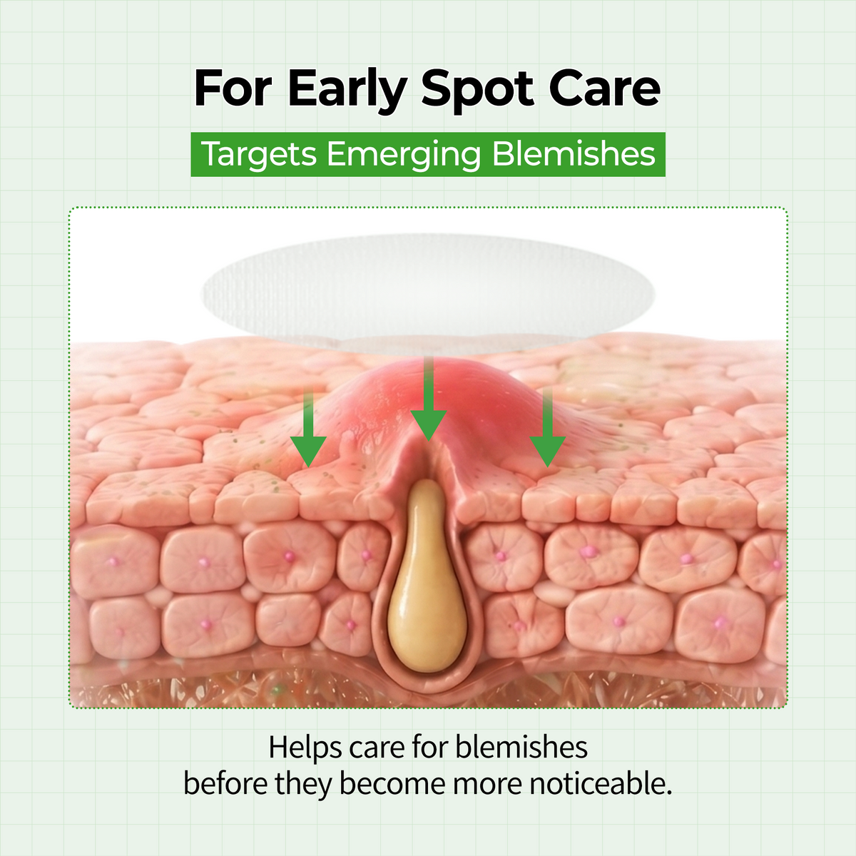 S-ZINC Zero-Fit Blemish Spot Patch