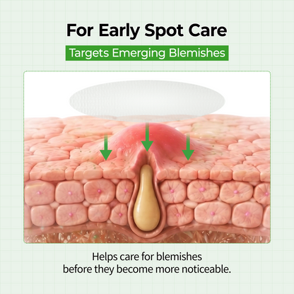 S-ZINC Zero-Fit Blemish Spot Patch